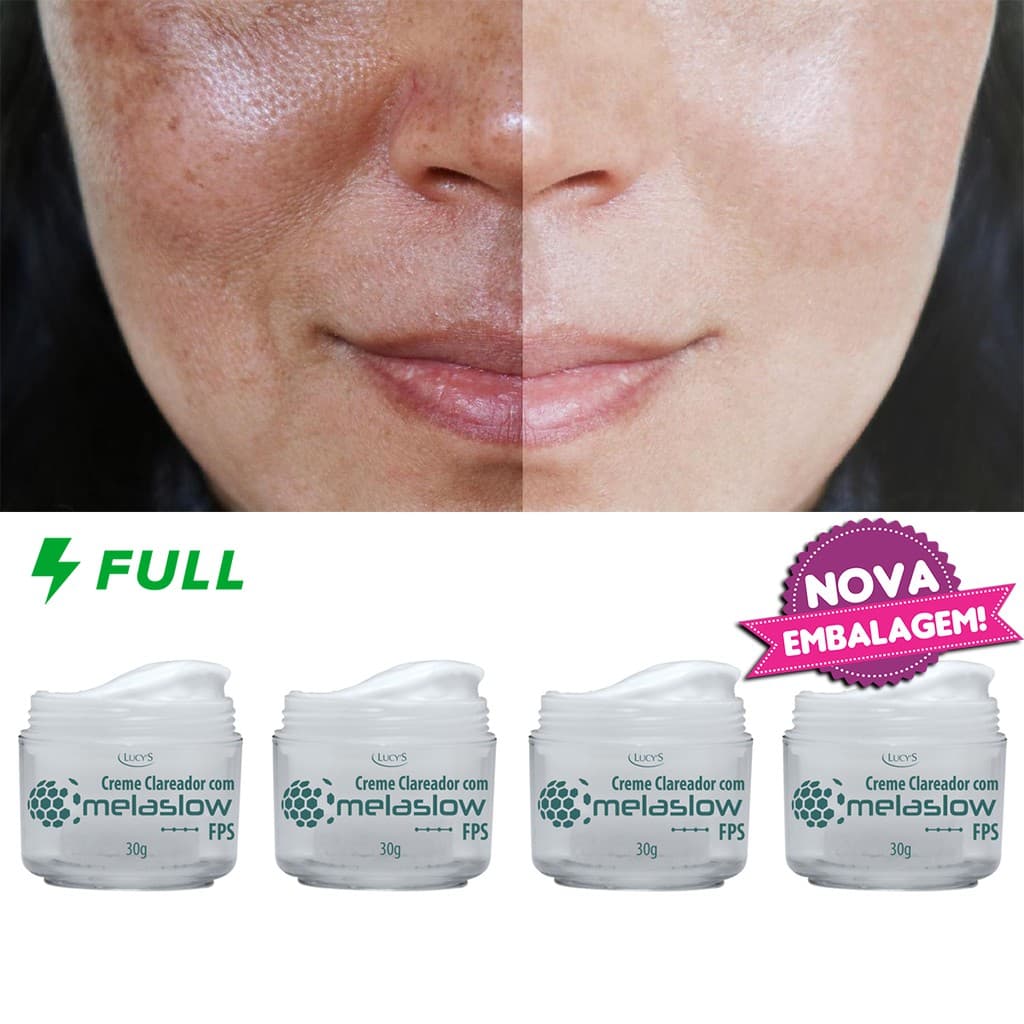 Kit 4 Cremes Para Clarear Manchas Faciais Escuras de Sol, Acne, Melasma, Sardas, Cicatrizes 30g Creme Clareador Facial