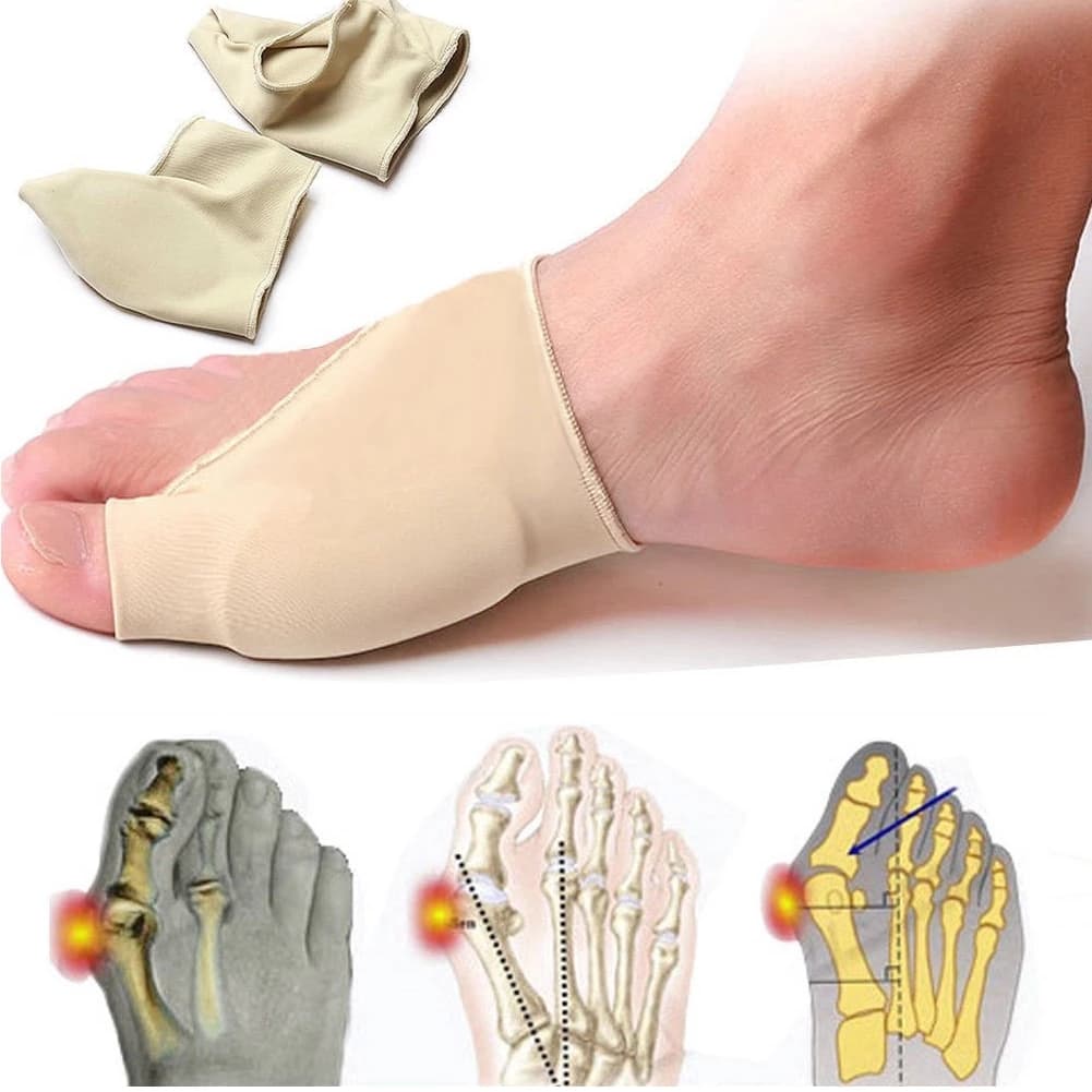 1 Par De Gel Toe Pé Corrector Hálux Valgo Protetor Mangas Joanete