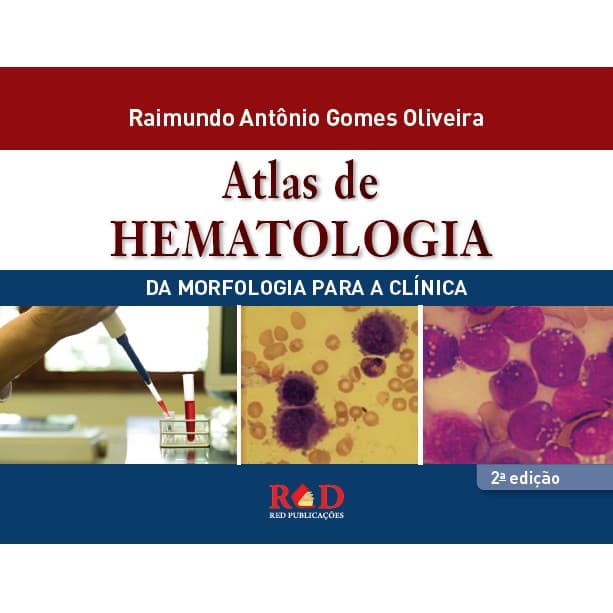 LIVRO ATLAS DE HEMATOLOGIA - da morfologia para a clinica - 2ª edição