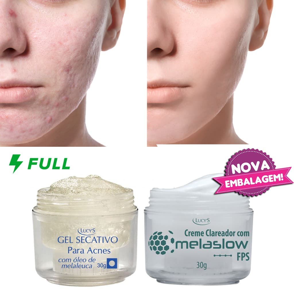 Kit Gel Secativo Para Acnes 30g + Clareador Manchas Cravos  espinhas 30g (Gel de Rápida Cicatrizar Espinha