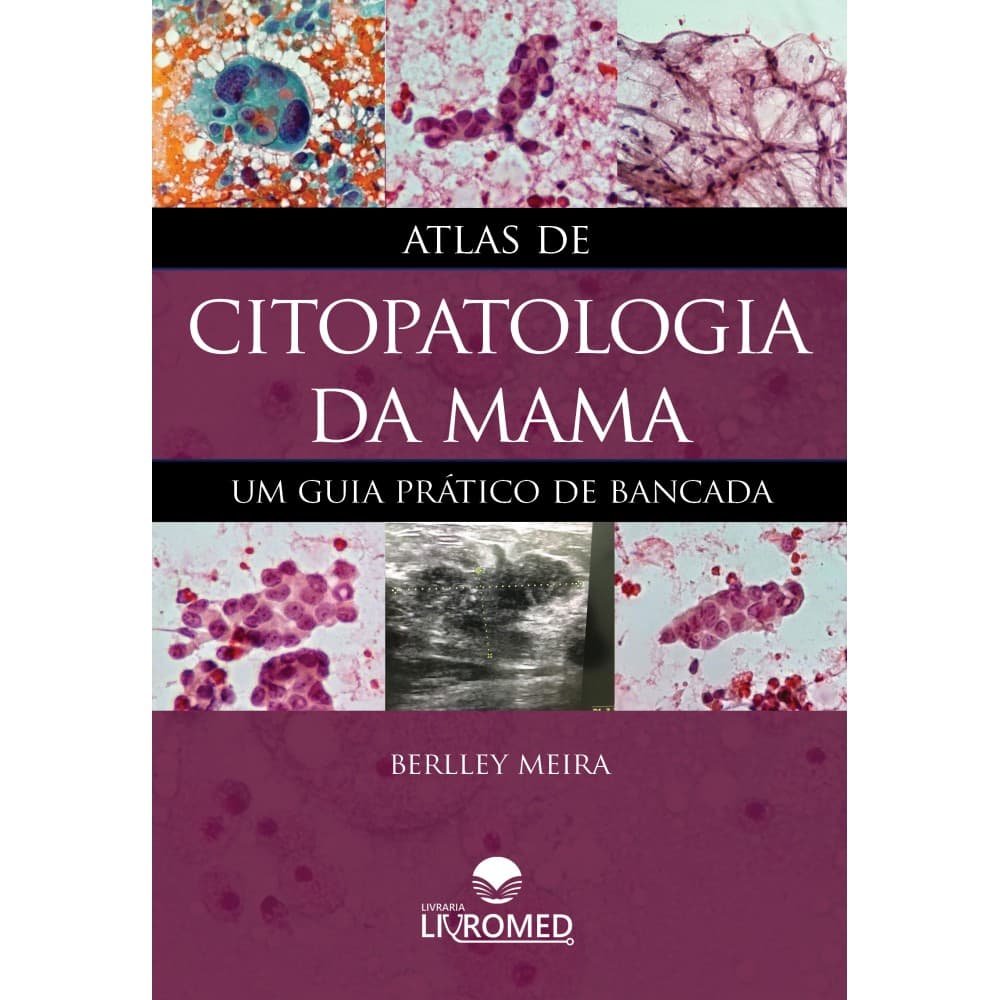Livro Atlas de Citopatologia da Mama - Um Guia Prático de Bancada