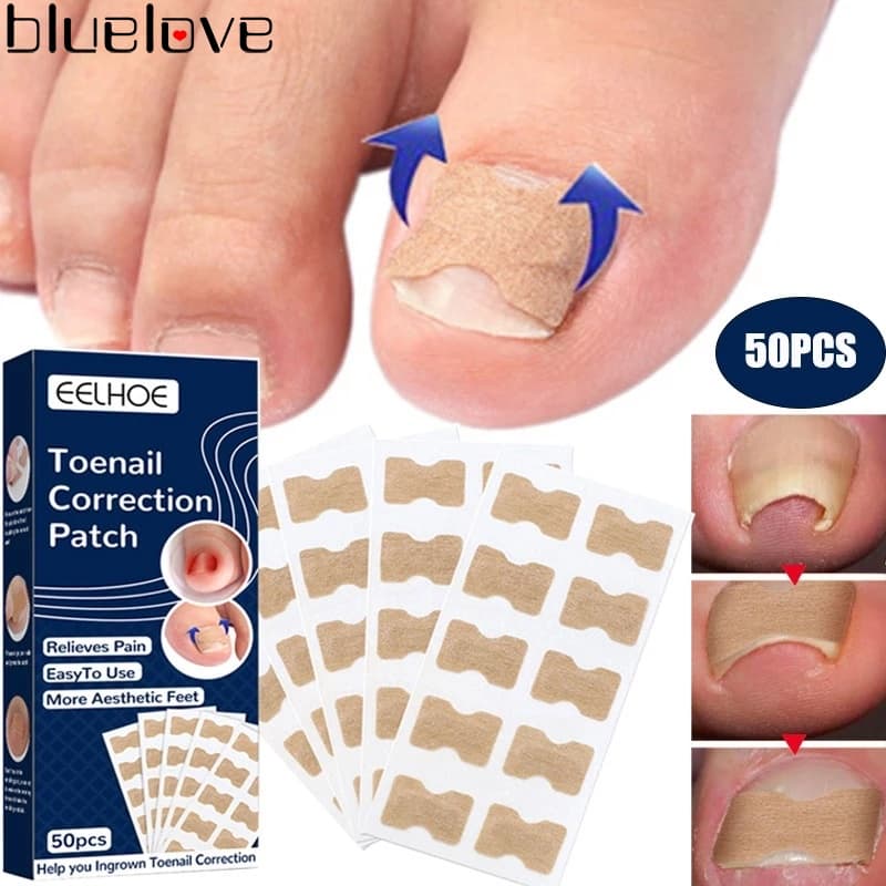 50 Pçs Adesivo Corretor De Unha Encravada À Prova Dwaterproof Água Paroníquia Tratamento De Unhas Recuperar Remendos De