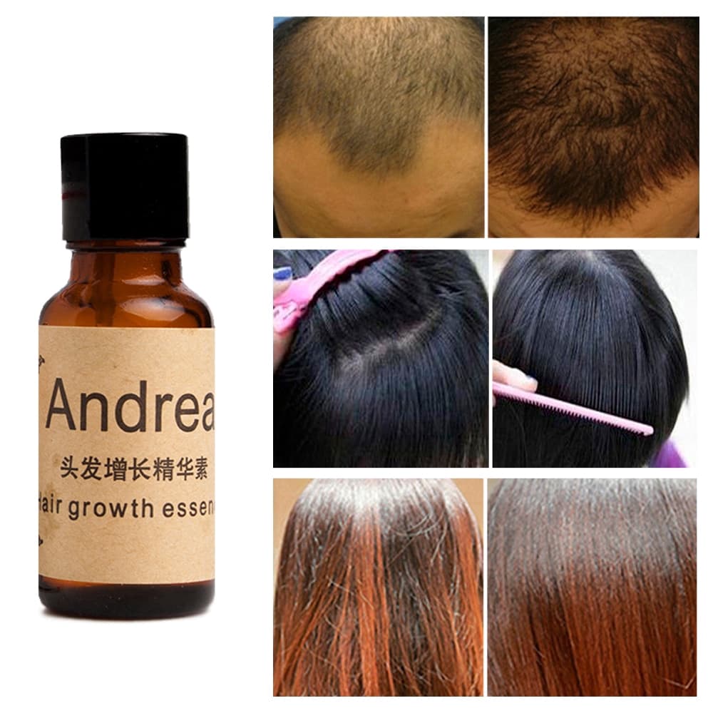 Fluido Para Crescimento De Cabelo Andrea 20ml