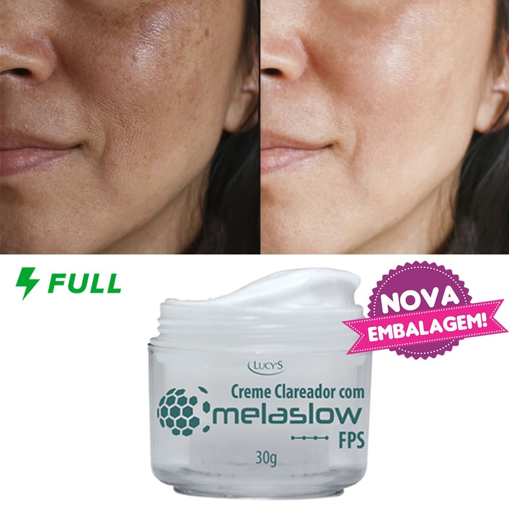 Creme Clareador De Manchas Faciais: Sardas, Melasma, Espinhas, Sol, Cicatriz de Acne (Não Descasca a Pele) Lucy's 30g