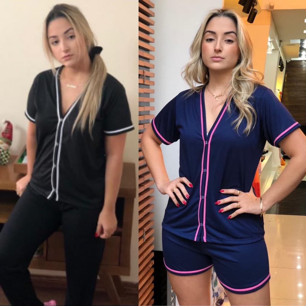 KIT 2 PIJAMAS BLOGUEIRINHA ABERTO COM BOTÕES PIJAMA INVERNO COM CALÇA E PIJAMA VERÃO SHORT CIRURGICO