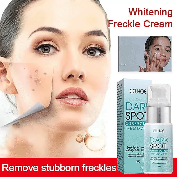 【Creme Facial】Pele Rejuvenescedora Remove Manchas Escuras Alivia a Melanina Hidratação/Anti-Manchas/Melhora Manchas