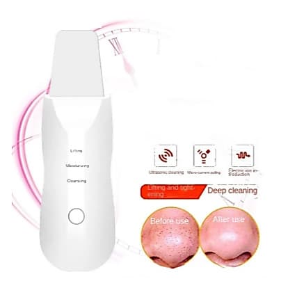 Peeling Esfoliador Ultrassônico para Limpeza Facial Profunda – Removedor de Cravos e Rugas