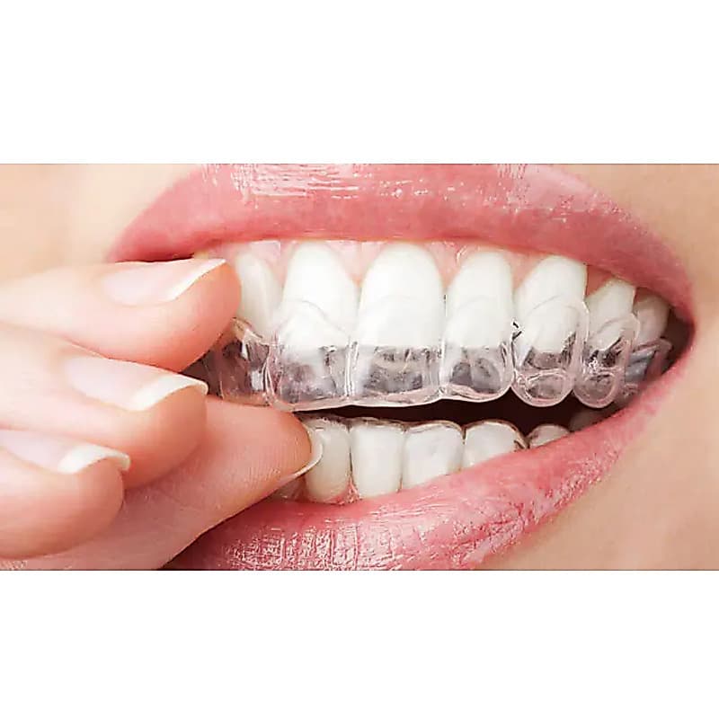 Placas Bruxismo Moldeira de Silicone Molde Caseiro Aparelho Protetor Inferior e Superior 2 unidades