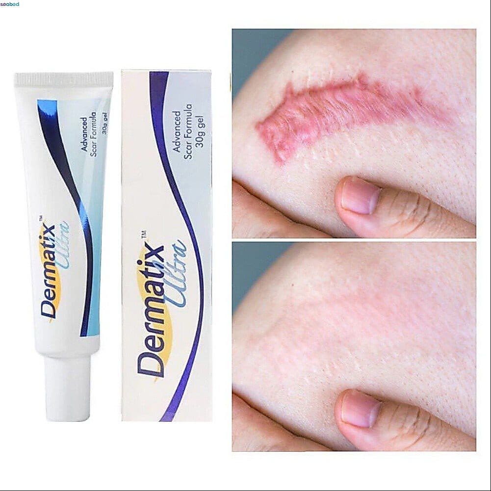 Creme para cicatrizes Formula Dermatix Ultra Advance para remover cicatrizes desbotadas (15g) fundo do mar