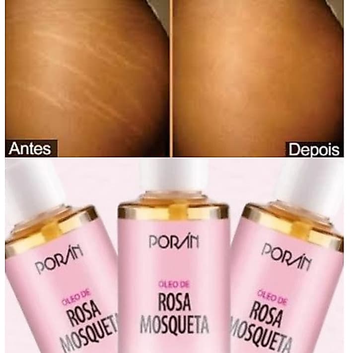 Óleo de Rosa Mosqueta Selvagem Corporal Reduz Estrias Estimula o Colágeno De 120ML