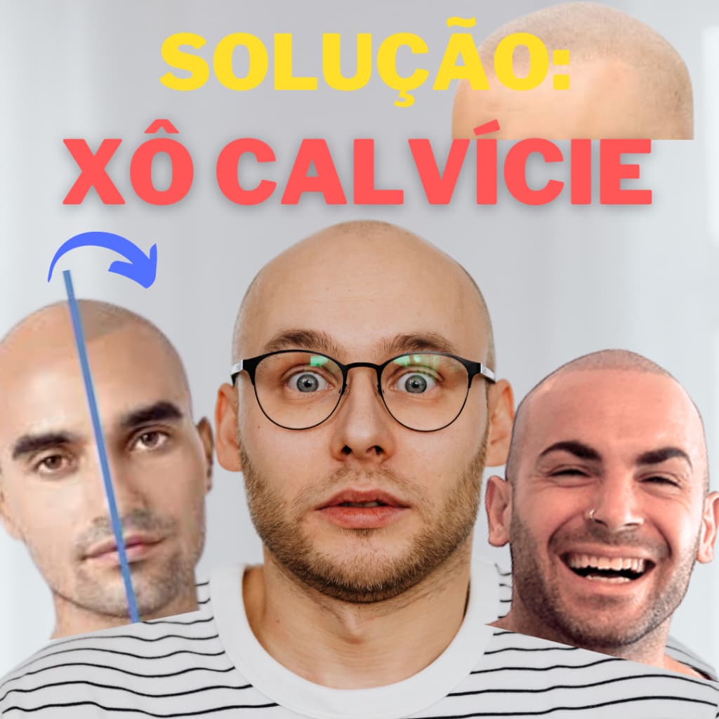 TATUAGEM TEMPORÁRIA  CALVÍCIE CARECA SKALP HAIR GROWTH PARA CAMUFLAR /