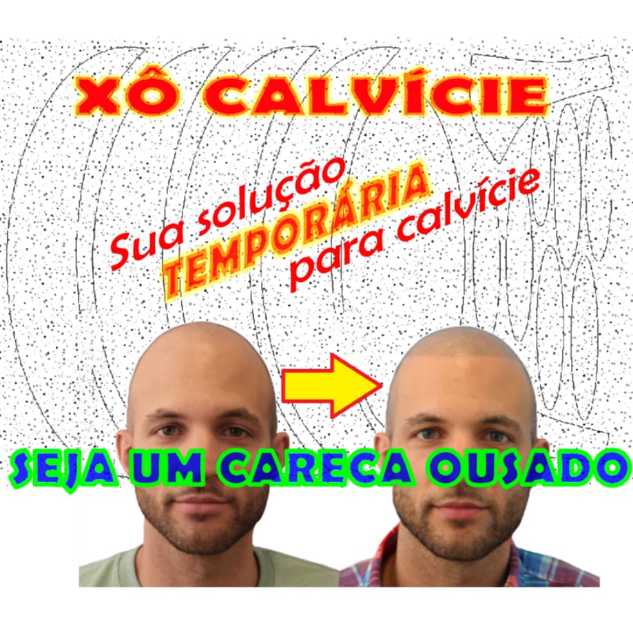 SOLUÇÃO TEMPORÁRIA SKALP HAIR GROWTH PARA CAMUFLAR A CALVÍCIE/CARECA