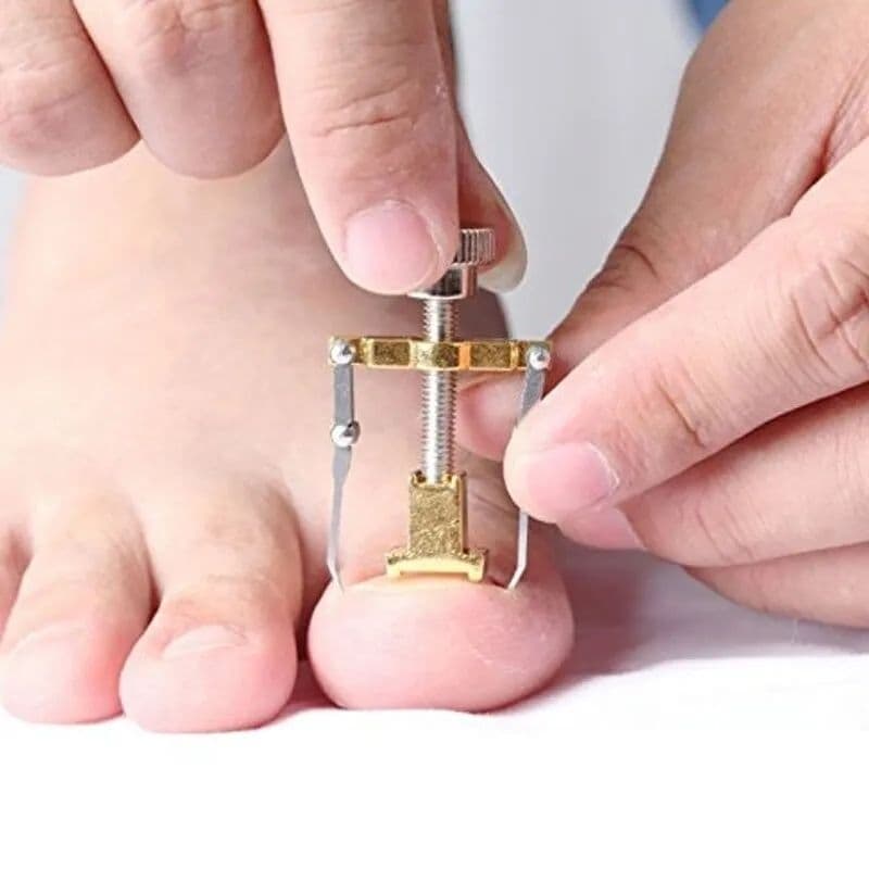 Desencravador de Unhas Manual Ajustável l