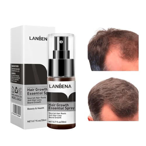 Spray Lanbena Calvicie Tratamento Capilar 20ml
