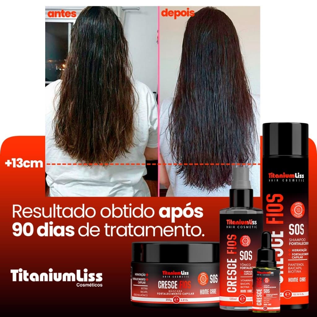 Kit Crescimento Capilar Sos Cresce Fios Titanium Liss Crescimento Rápido - Combate Queda Calvície Falha -Alopecia -