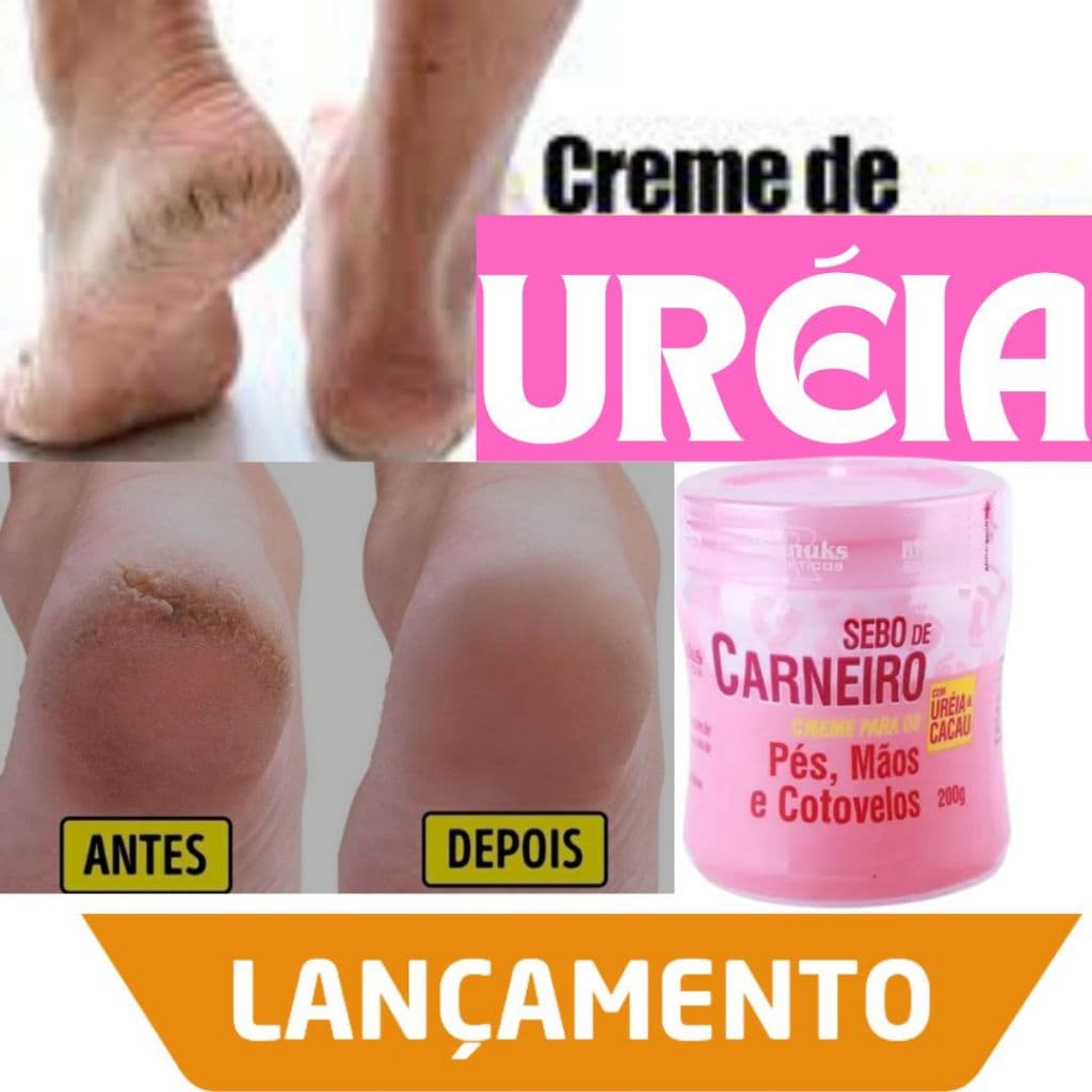 Creme para pés secos e rachados: previne rachaduras e ressecamento, hidrata a pele seca, melhora o ressecamento