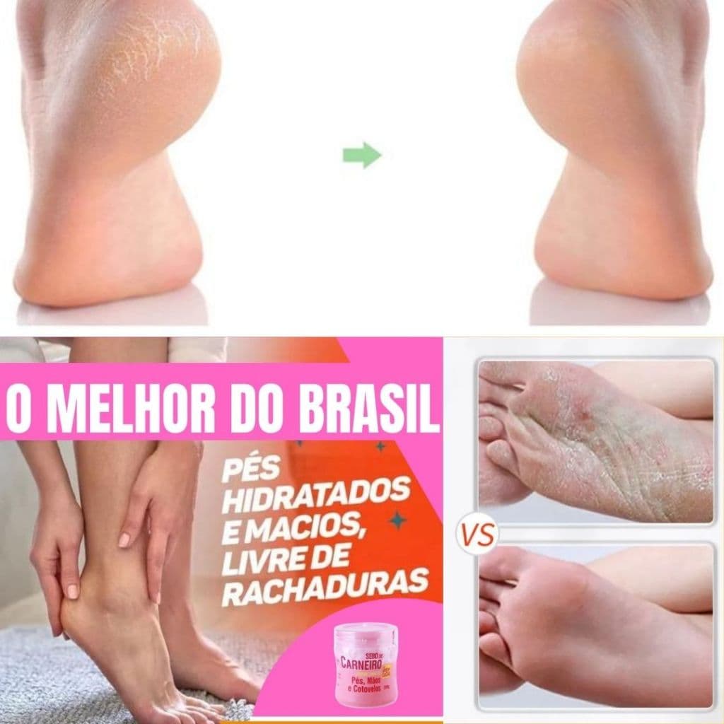 Creme sebo de carneiro hidrata - pés, mãos e cotovelos - pote 200 g