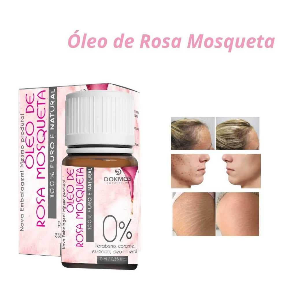 Óleo Vegetal de Rosa Mosqueta 100% Puro | Elimina Manchas, Anti Estrias e Celulites 10ml