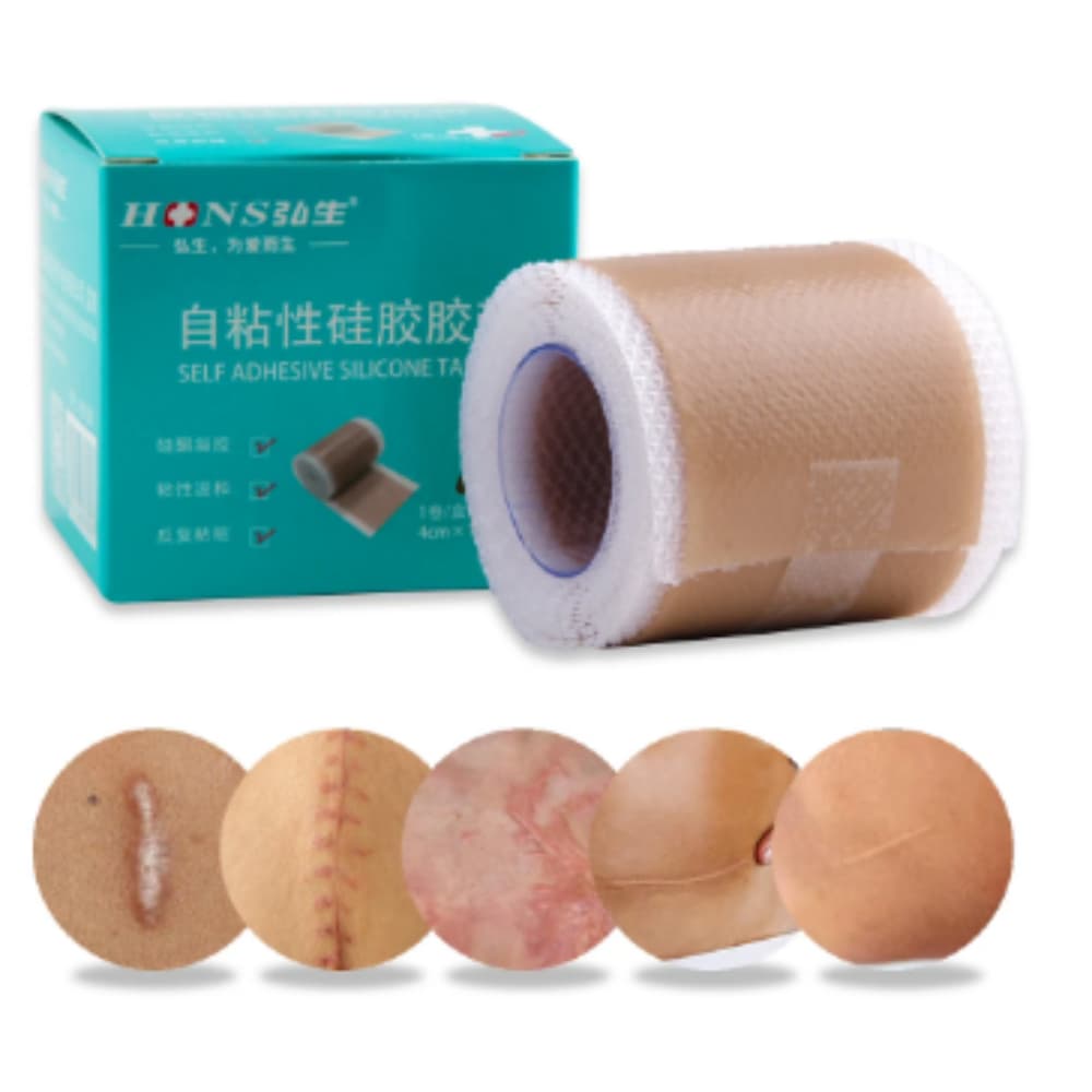 Silicone Adesivo Fita De Cicatriz Reduz Remove Aliver 50 cm