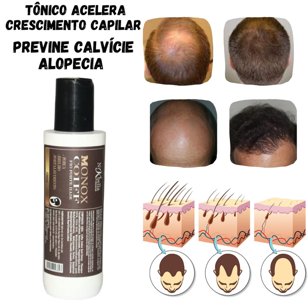 Tônico Crescimento e Fortalecimento capilar Calvice Masculina e Feminina