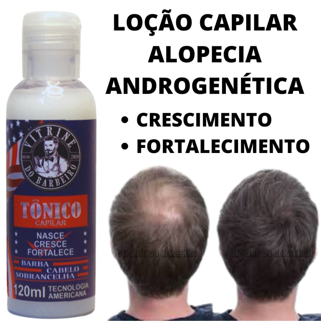 Tônico P/ Fortalecimento Capilar Unissex Alopécia Areata