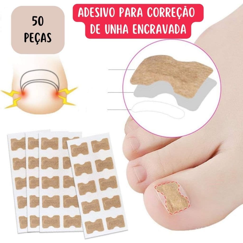Kit 50 Adesivos Órtose Correção de Unhas Encravadas Manicure Pedicure