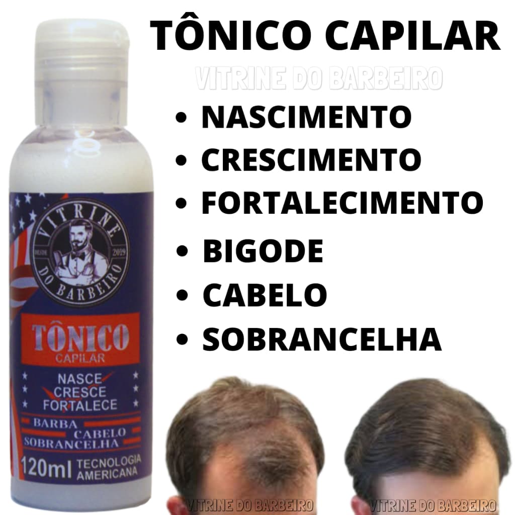 Tônico Capilar Para Fortalecimento Do Cabelo Evita Queda