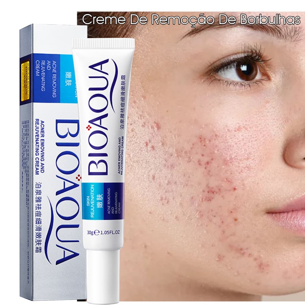 Creme De Remoção De Borbulhas Para Tratamento De Cicatrizes/Anti-Acne/Branqueamento/Controle De Oiliness/Poros Escuros