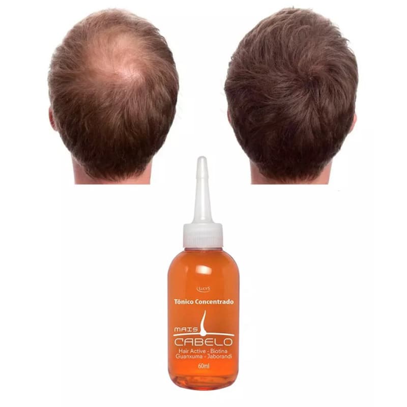 Tônico Ant queda Calvice cabelo caindo cabelo ralo fortalece e estimula o crescimento capilar 60ml