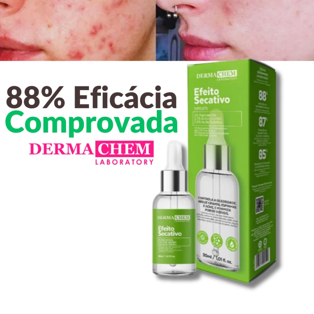 Sérum Efeito Secativo para Espinhas e Acnes Dermachem 30ml