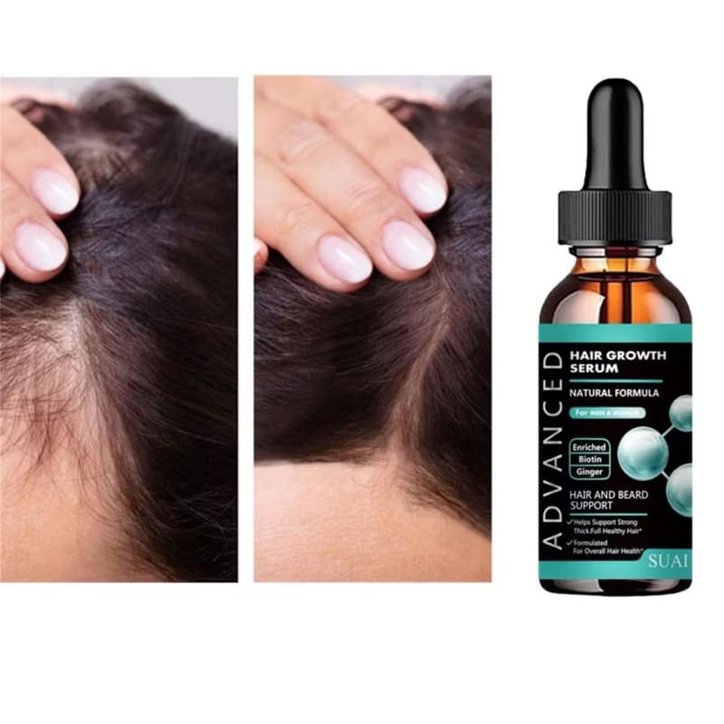 1 Óleo Para Crescimento Rápido Do Cabelo envio no mesmo dia