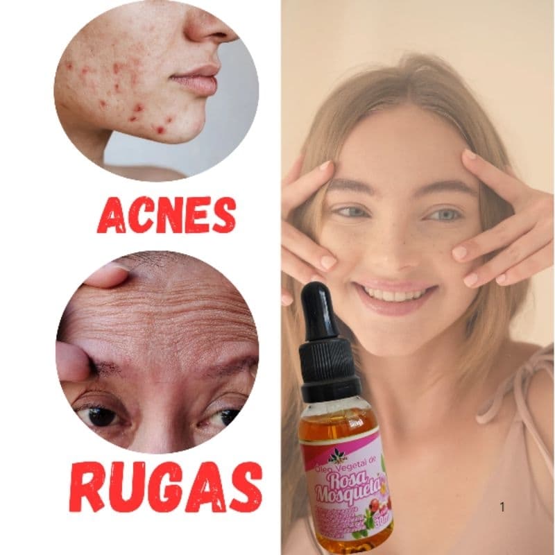 Óleo Rosa Mosqueta 100% Puro 30ml