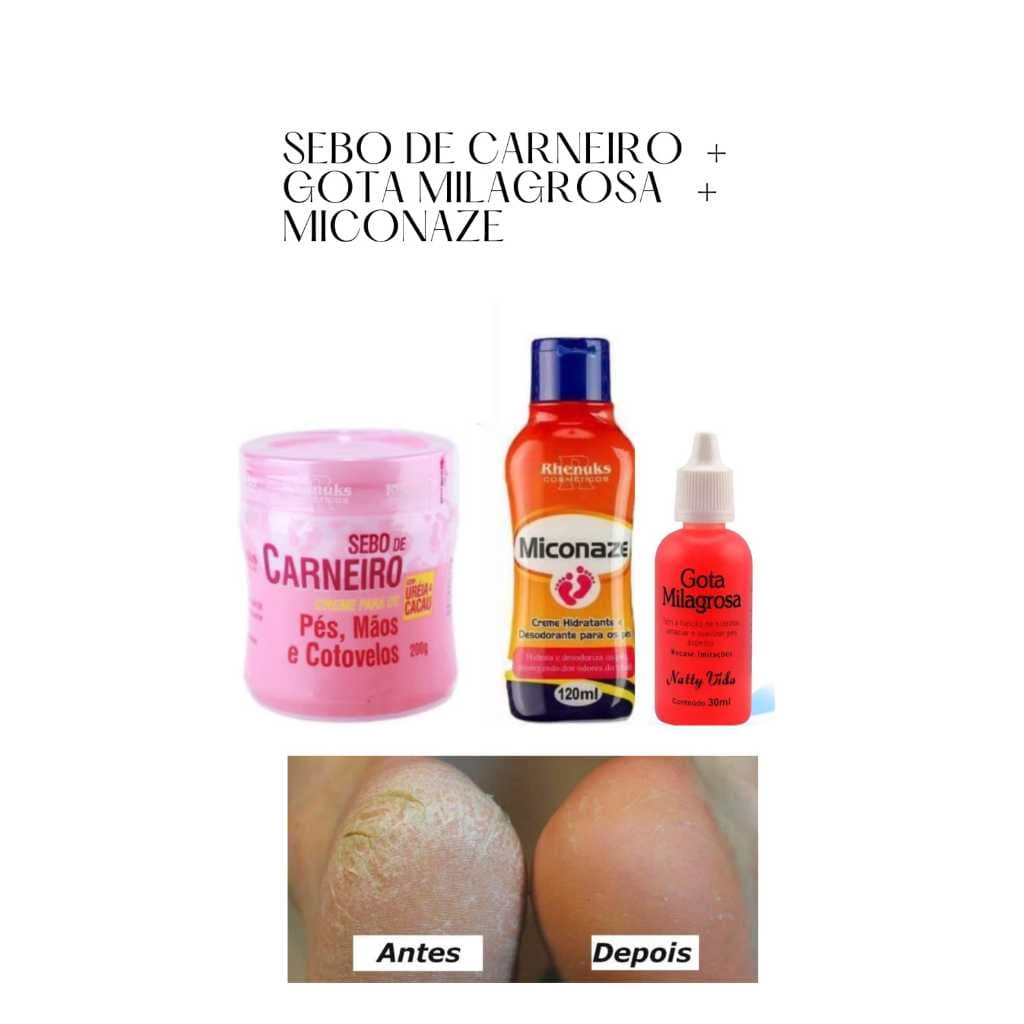 Kit para Rachaduras! Gota milagrosa + Sebo de Carneiro + Creme Miconaze