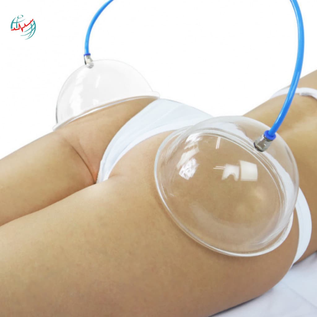 Ventosas Para Glúteos Pump Up 19cm Com Engate 6mm