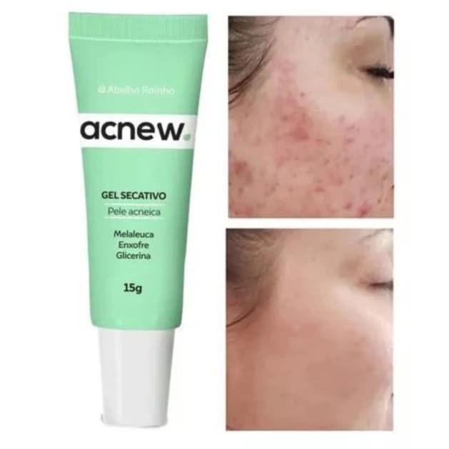 Gel Secativo Cravo E Espinha Acnew Ação Anti-inflamatória Abelha Rainha - 15g