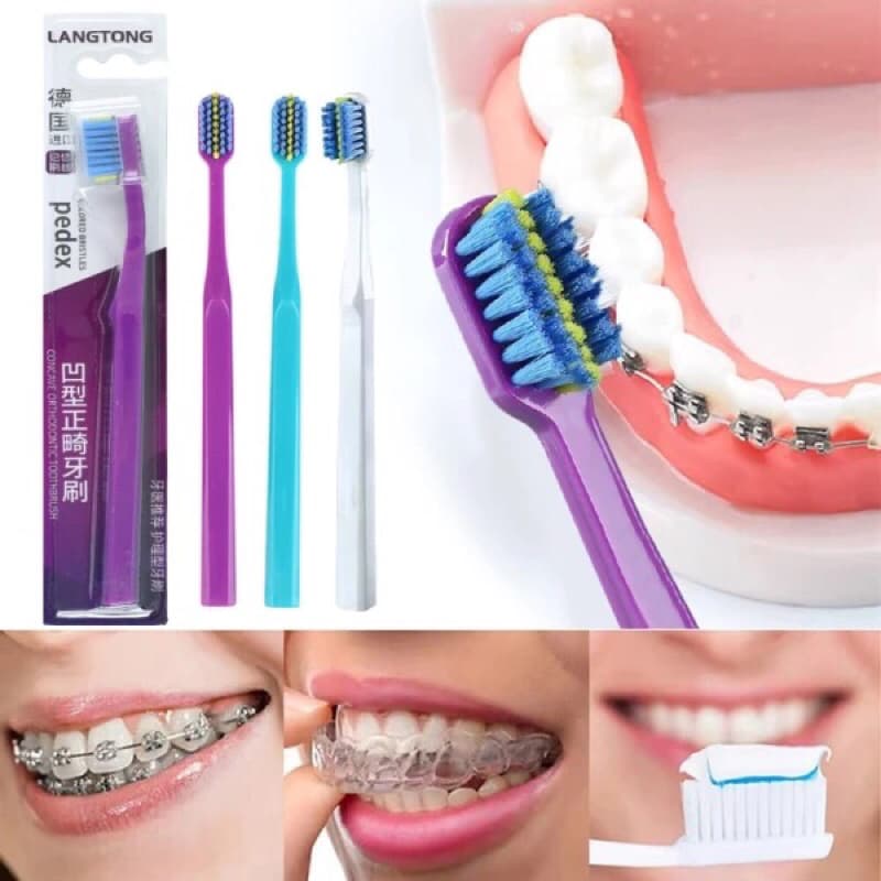 3 Escova de Dente Aparelho Ortodôntico Adulto Escovas Dentes Ortodônticas Cerdas Macias Cuidado