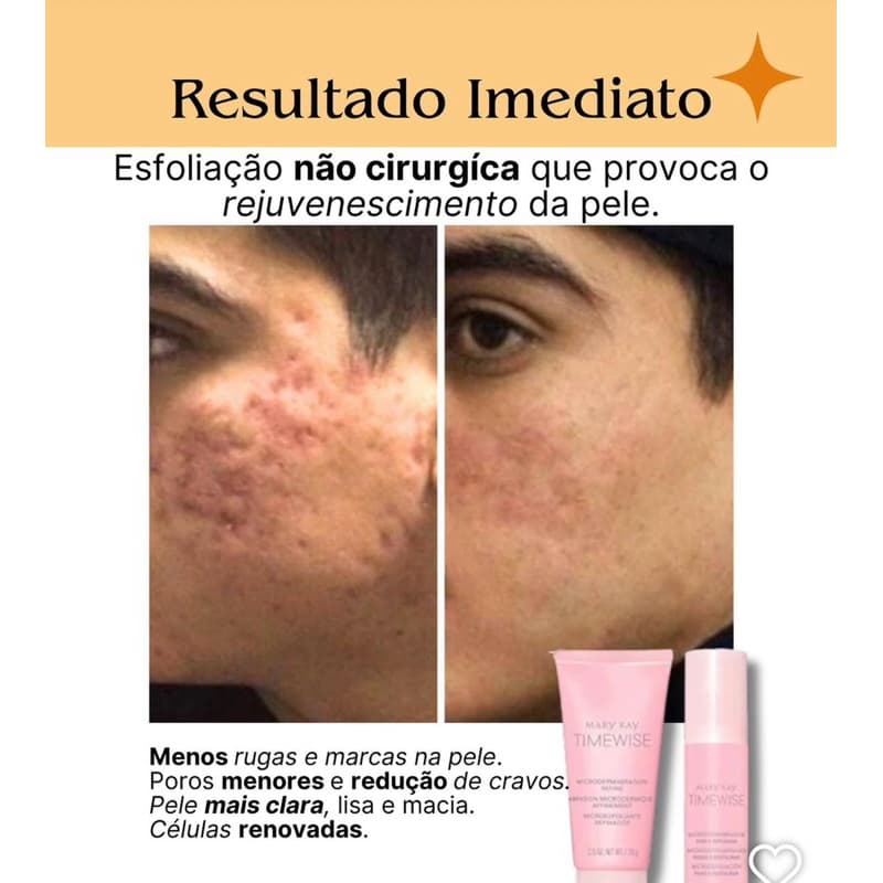 Peeling de Crystal Esfoliante Facial pelling