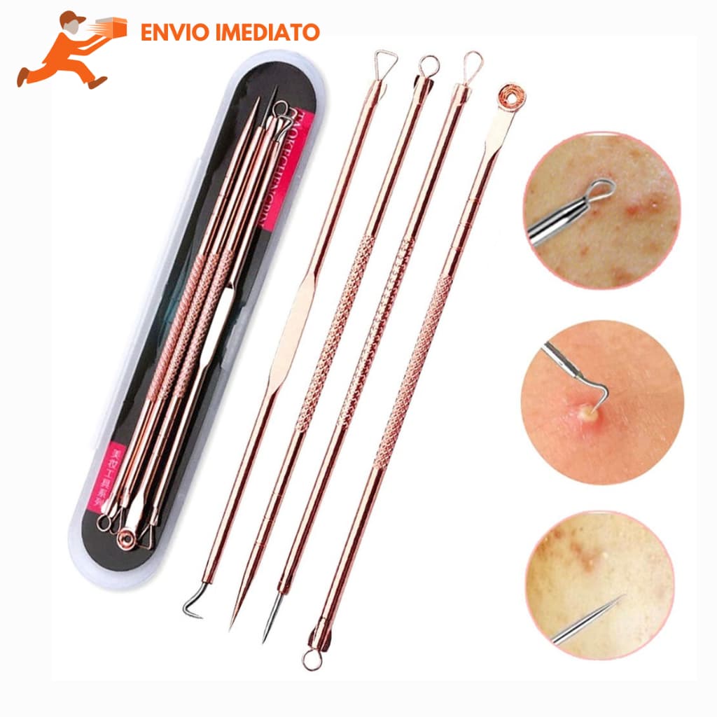 Kit Acne Extrator 4 Peças - Removedor de cravos e espinhas Envio Imediato 24h