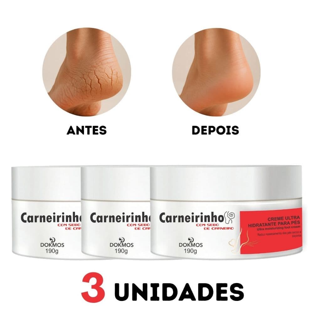 Kit 3x Creme Hidratante Pés Mãos Ressecados  Carneirinho Alívio para Rachaduras e Ressecamento Spa dos Pes 190g Dokmos