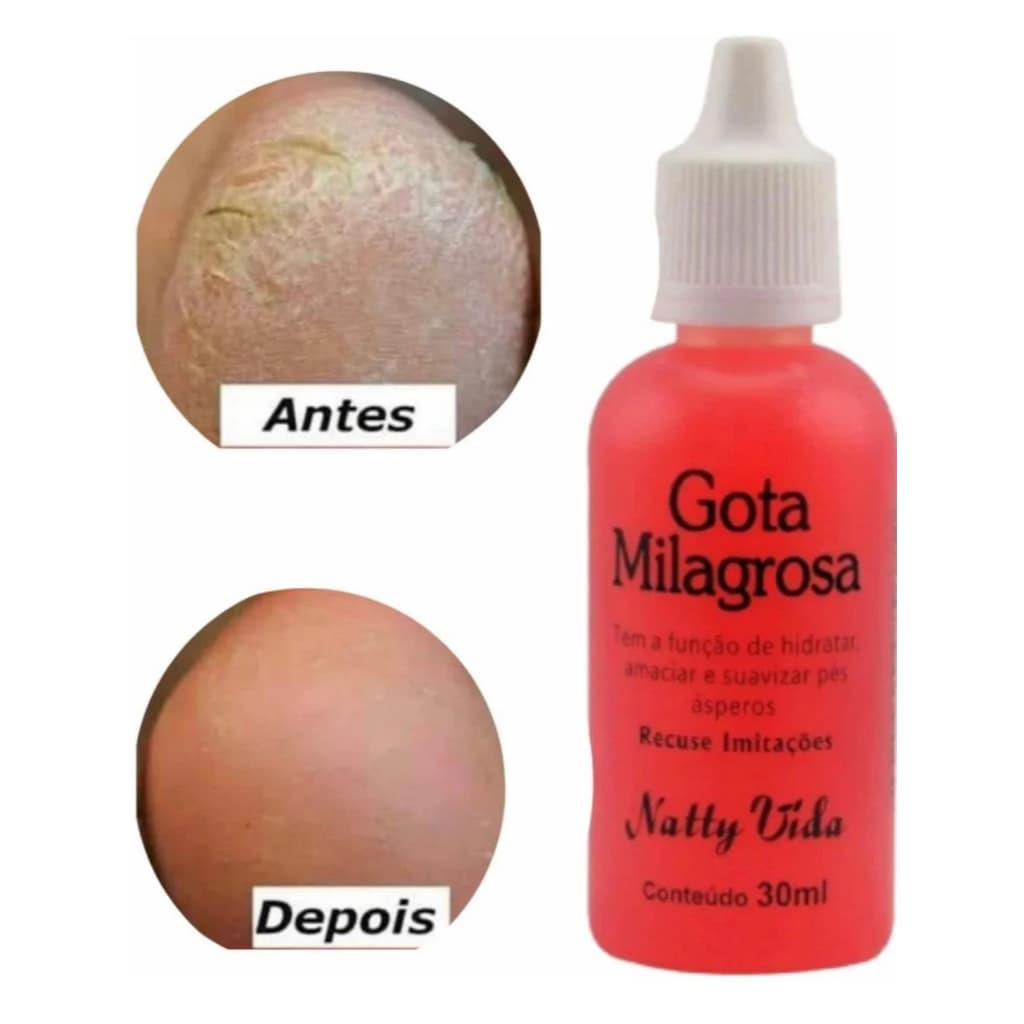 Kit com 12 Gota Milagrosa Natty Vida Para Pés Combate Rachadura Ressecamento