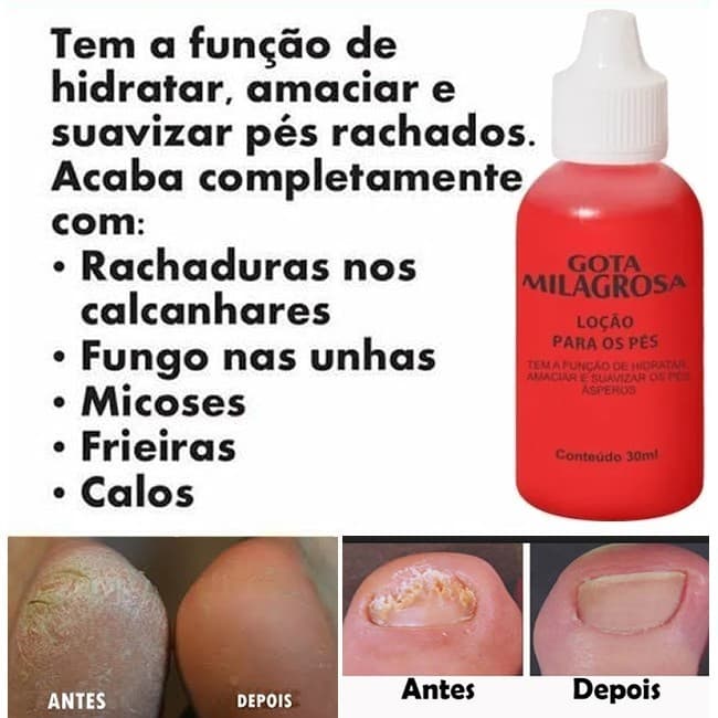 Kit 24 Gota Milagrosa Para os Pés Natty vida - combate rachaduras e ressecamento