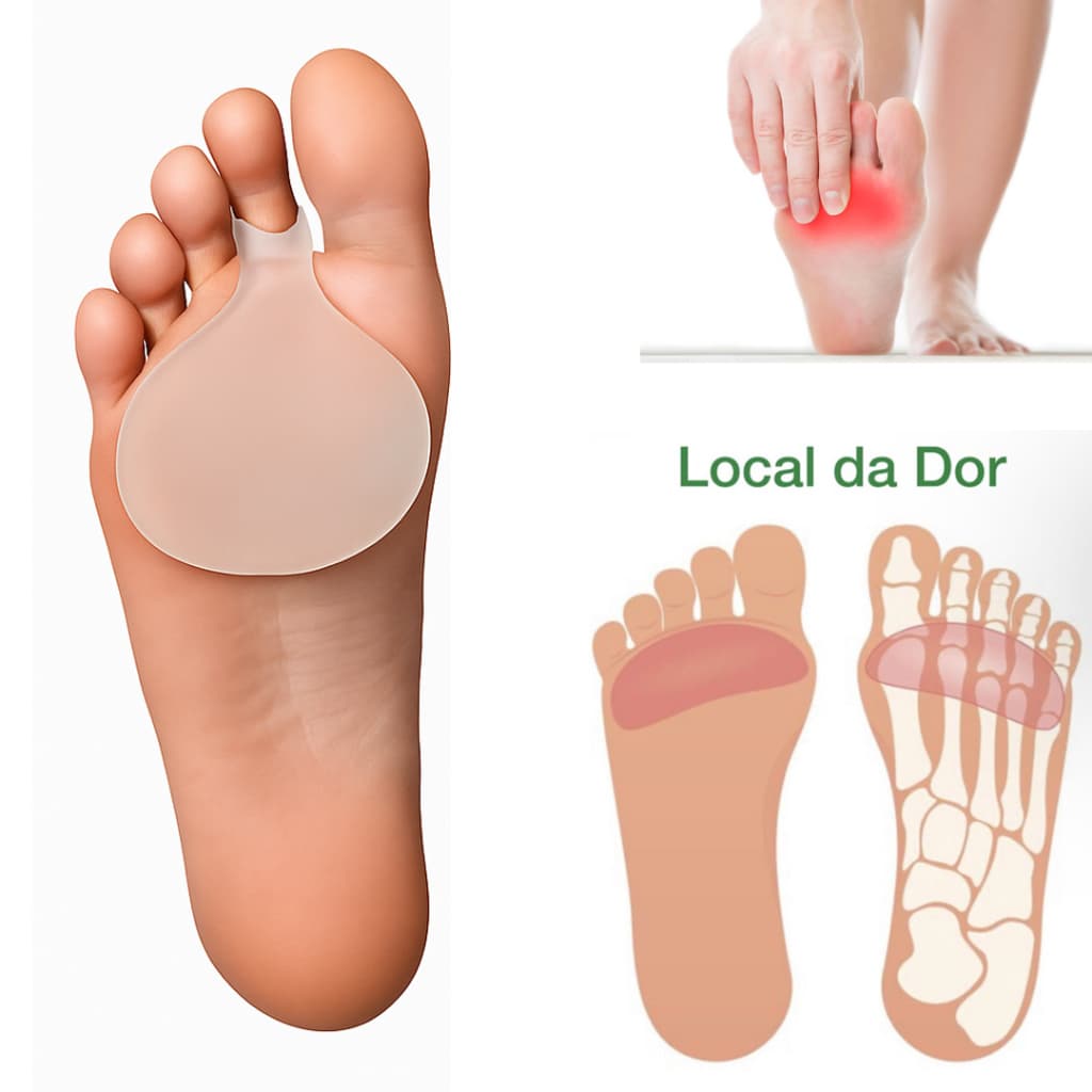 Protetor Plantar com Anel Take Care – 100% Silicone com Registro ANVISA – Par (2 unidades)