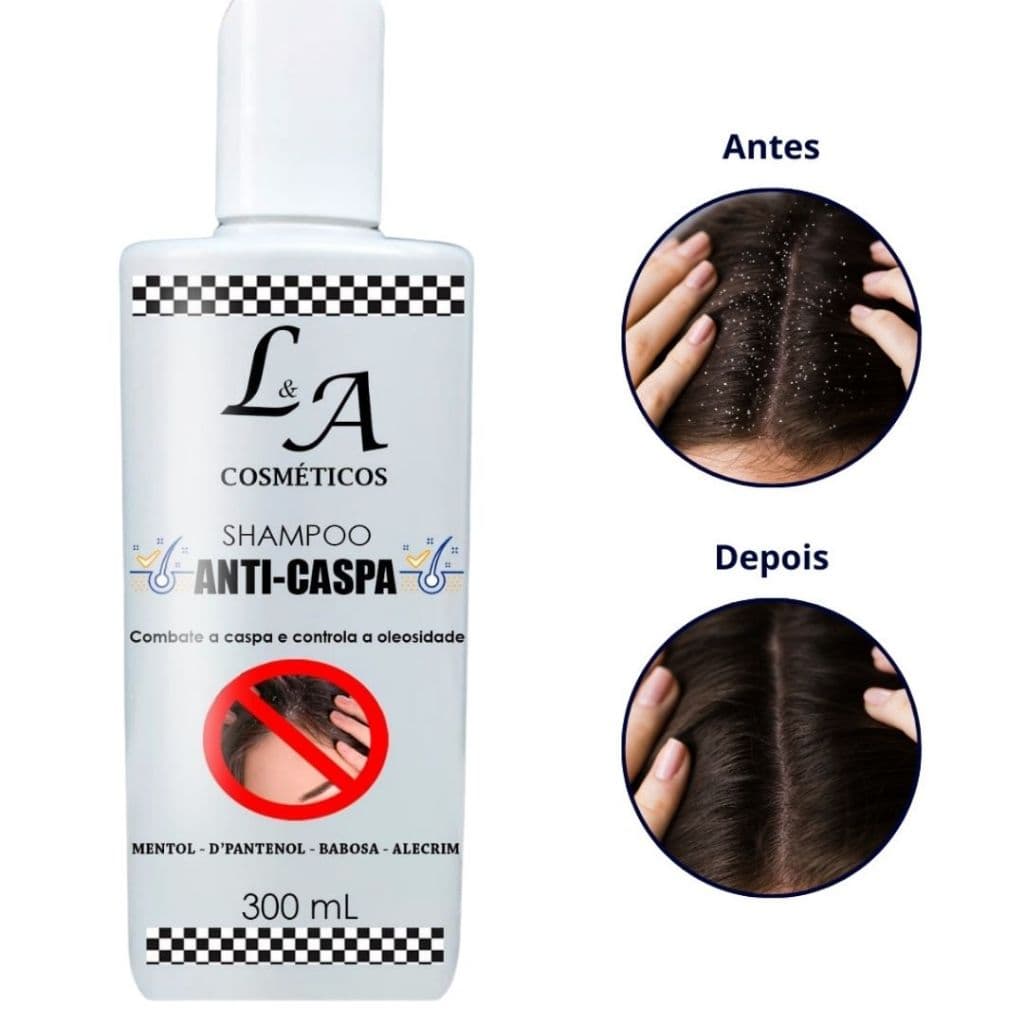 Shampoo Anticaspa com Babosa (Aloe Vera) Mentol D'Pantenol Alecrim tratamento da caspa e oleosidade