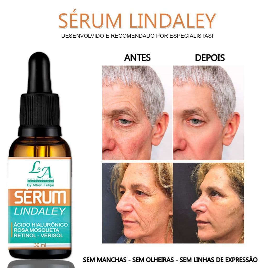 Sérum Lindaley Rico em Ácido Hialurônico / Retinol - Verisol / Rosa Mosqueta Antioxidante Vitamina C