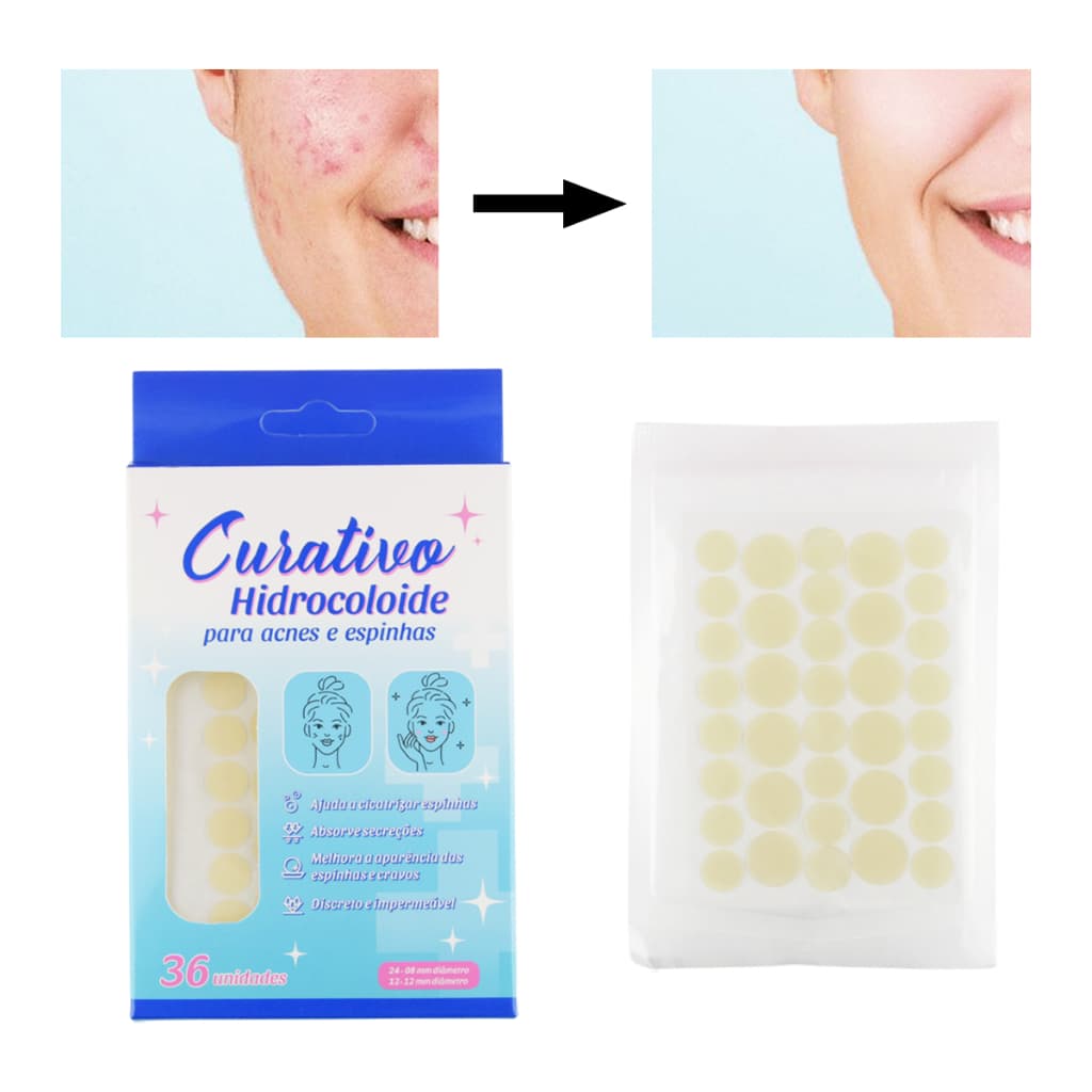 Adesivo Hidrocolóide para Acnes e Espinhas 36 Unidades diferentes tamanhos estética cravos inflamação seca trata