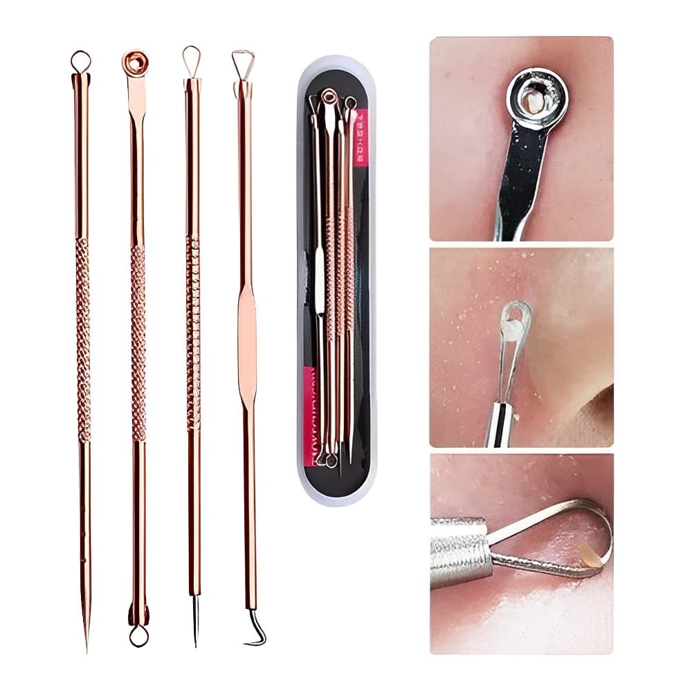 Kit 4 Ferramentas de Beleza Extrator de Acne Removedor de Cravo Espinha Aço Inoxidável Agulhas