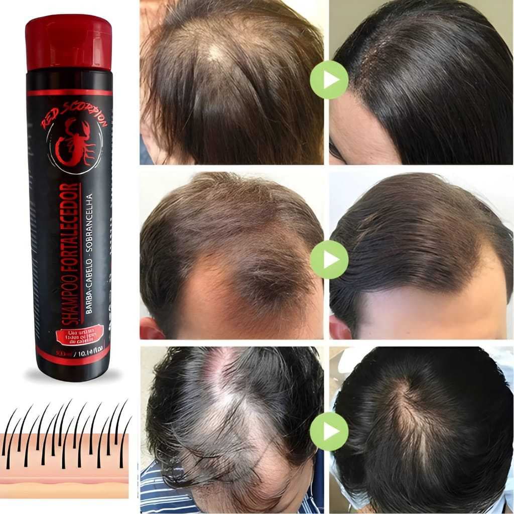 Shampoo de Crescimento e Fortalecimento Red Scorpion 300 ML, Antiqueda, Salão, para Cabelo, Barba e Sobrancelha