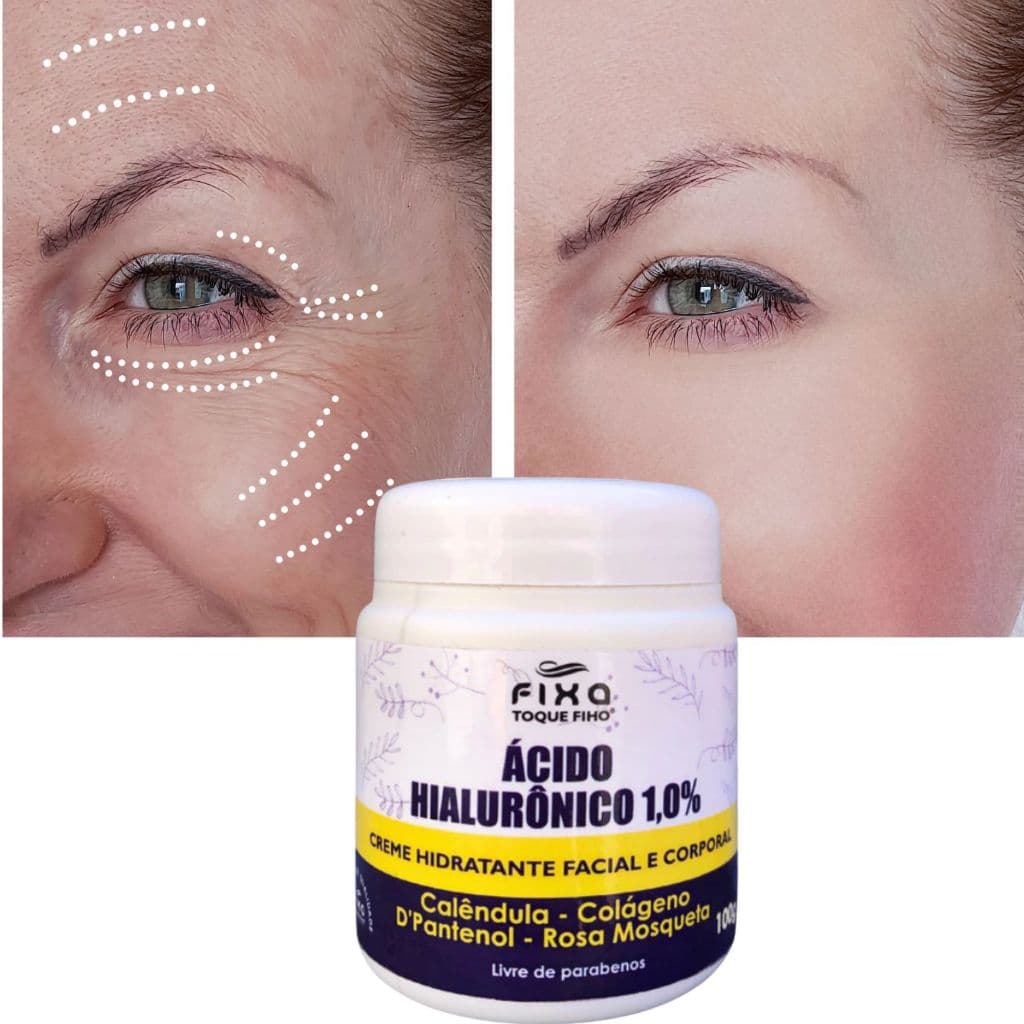 Creme Ácido Hialurônico 100G  Anti Rugas Colágeno E Rosa Mosqueta Hidratante Facial Reduz Linhas De Expressão