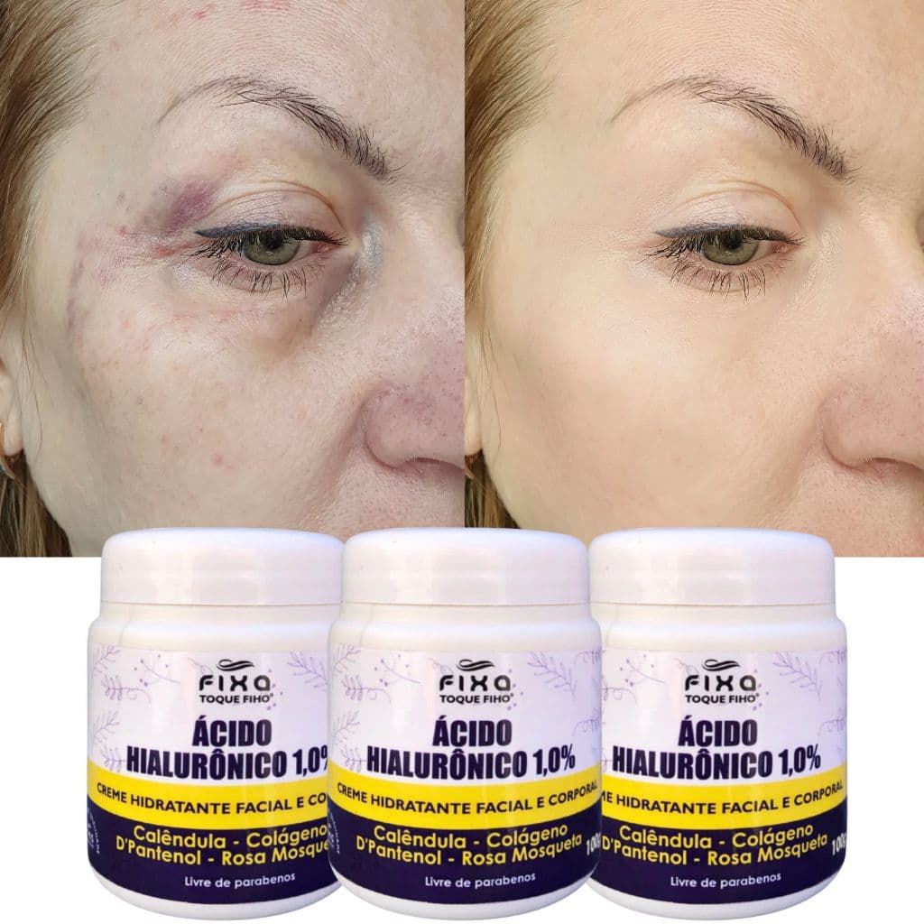 Creme Hidratante Facial Ácido Hialurônico  Anti Rugas 100G Colágeno E Rosa Mosqueta Reduz Linhas De Expressão