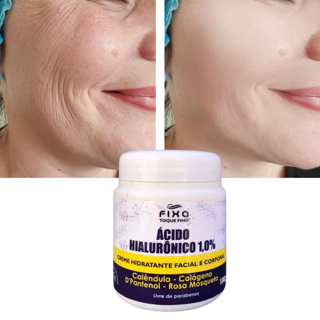 Creme Anti Rugas Ácido Hialurônico 100G Colágeno E Rosa Mosqueta Hidratante Facial Reduz Linhas De Expressão